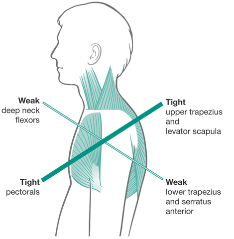 Neck and Shoulder Stretches for Tension Relief